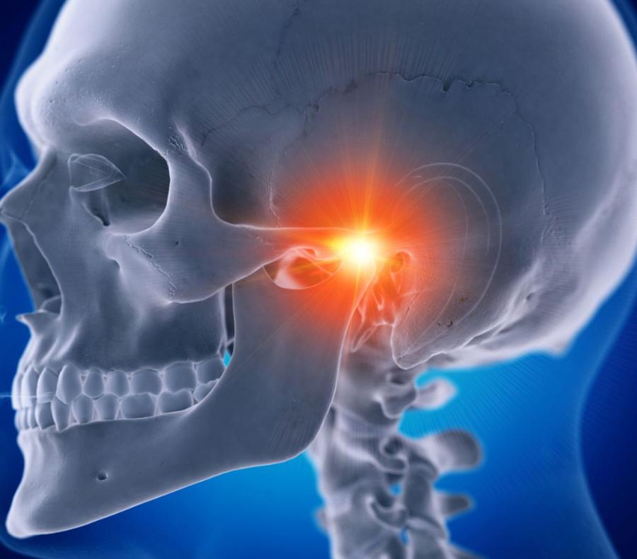 Dolore causato dal disordine temporo mandibolare (DTM)