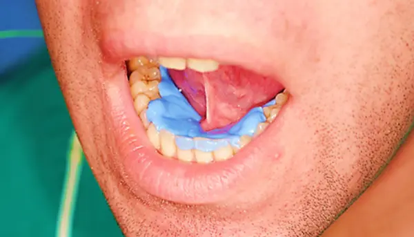 La registrazione del dispositivo E. LI.BA.: un percorso clinico-tecnico integrato